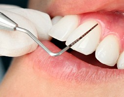 Vai alla pagina: Parodontologia per igienisti dentali